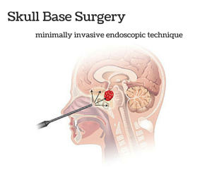 Ramin Rak | Skull Base Surgery